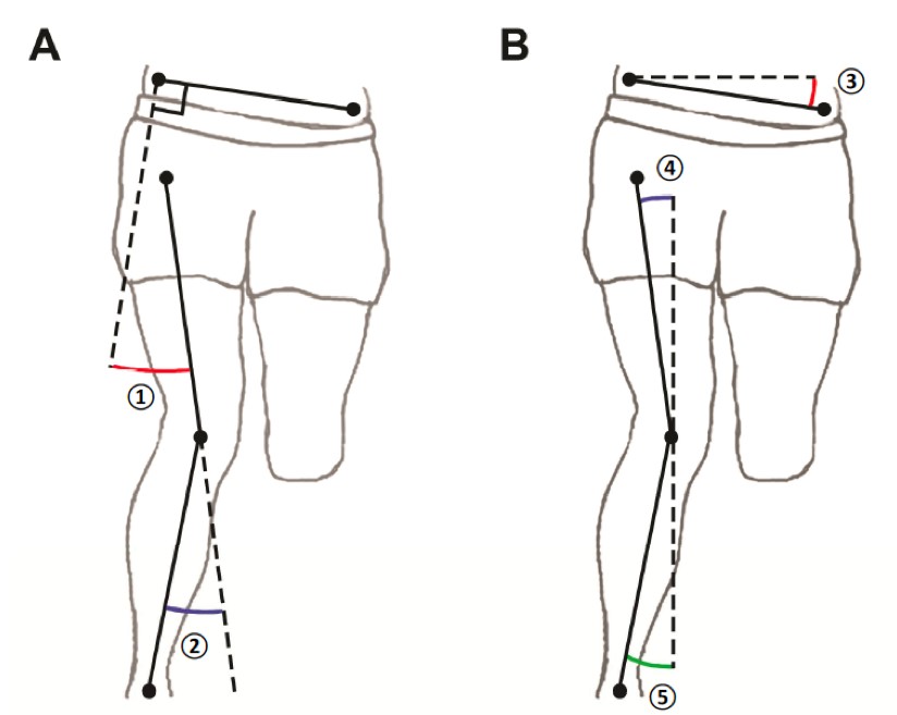 L’analyse cinématique du plan frontal prédit le niveau d’adduction tridimensionnel de la hanche lors de la course.