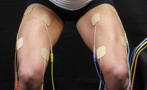 La stimulation électrique neuromusculaire est efficace pour renforcer le muscle quadriceps après une chirurgie du ligament croisé antérieur