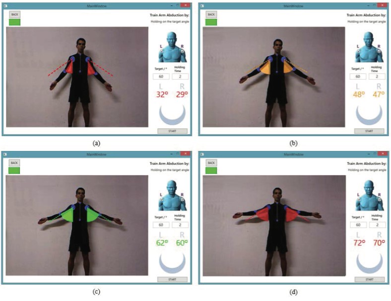 Utilisation d’un système de biofeedback en temps réel grâce à une interface visuelle lors d’une réhabilitation