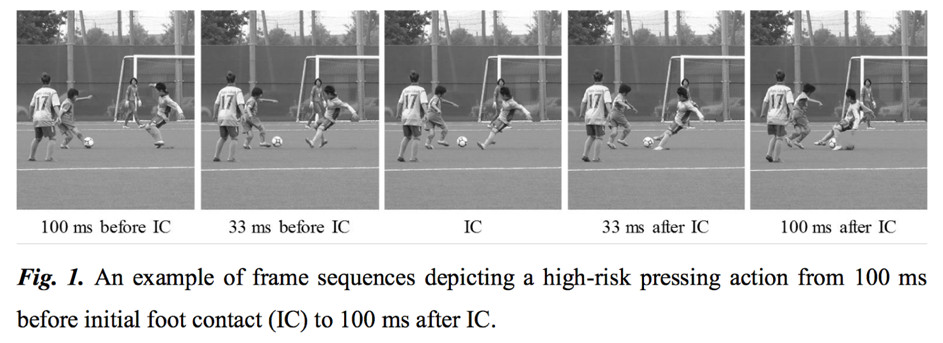 Analyse cinématique des situations de pressing dans le football féminin universitaire : nouvel aperçu des causes de lésion du LCA.