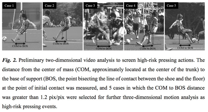 Analyse cinématique des situations de pressing dans le football féminin universitaire : nouvel aperçu des causes de lésion du LCA.