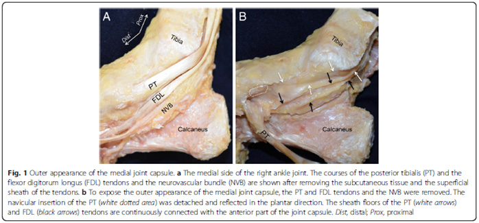Etude anatomique du bord médial de la cheville au niveau de la capsule articulaire : description alternative du spring ligament et du ligament deltoïdien 