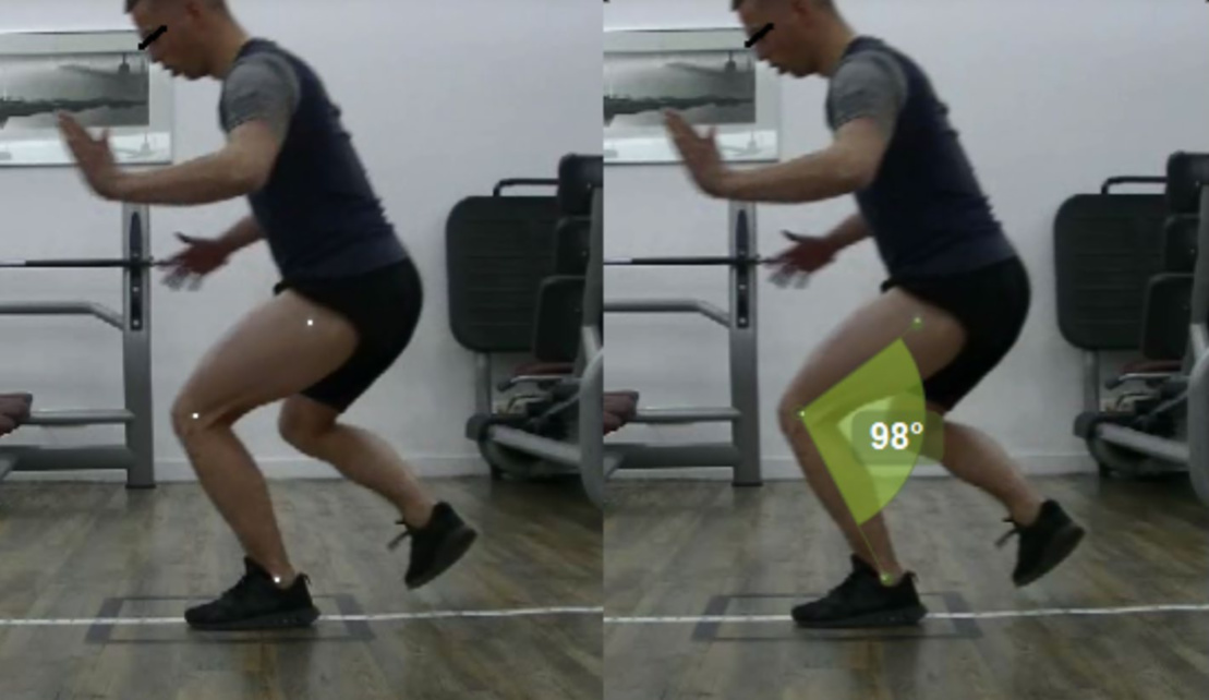 Fig. 1 Example of a patient performing the SLH from the sagittal plane, with markers on the trochanter major, lateral epicondyle of the femur and the lateral malleoli (left), and the knee flexion angle calculation (right)