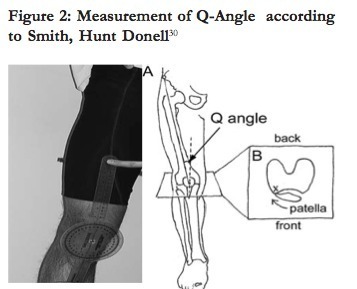 Q-angle, largeur du pelvis, distance Intercondylienne: intéractions dans les blessures de genou des footballeuses ?