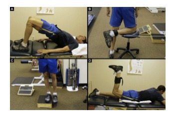 Approche clinique : renforcement du moyen fessier et utilisation du Donatelli Drop Leg Test chez l'athlète