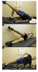 Approche clinique : renforcement du moyen fessier et utilisation du Donatelli Drop Leg Test chez l'athlète