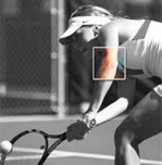 Délai de récupération fonctionnelle après chirurgie par arthroscopie pour un tennis elbow