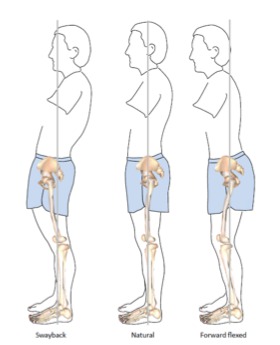 Effet de la posture sur les moments et les angles de la hanche pendant la marche
