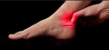 L'inflammation chronique est une caractéristique de la tendinopathie et de la rupture du tendon d'Achille