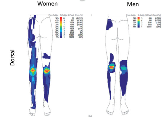Descripteurs cliniques pour la reconnaissance de la sensibilisation centrale de la douleur chez les patients souffrant d'arthrose du genou