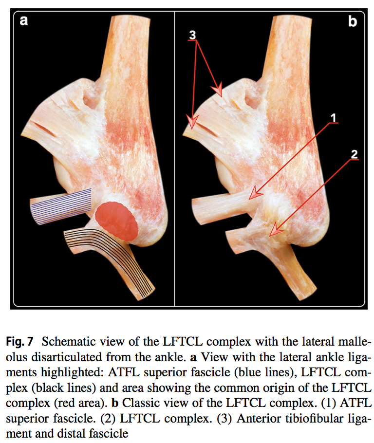 Lateral FibuloTaloCalcaneal Ligament (LFTCL) complex : une nouvelle donnée anatomique pour le compartiment externe de cheville