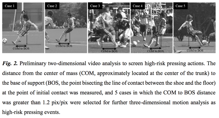 Analyse cinématique des situations de pressing dans le football féminin universitaire : nouvel aperçu des causes de lésion du LCA.