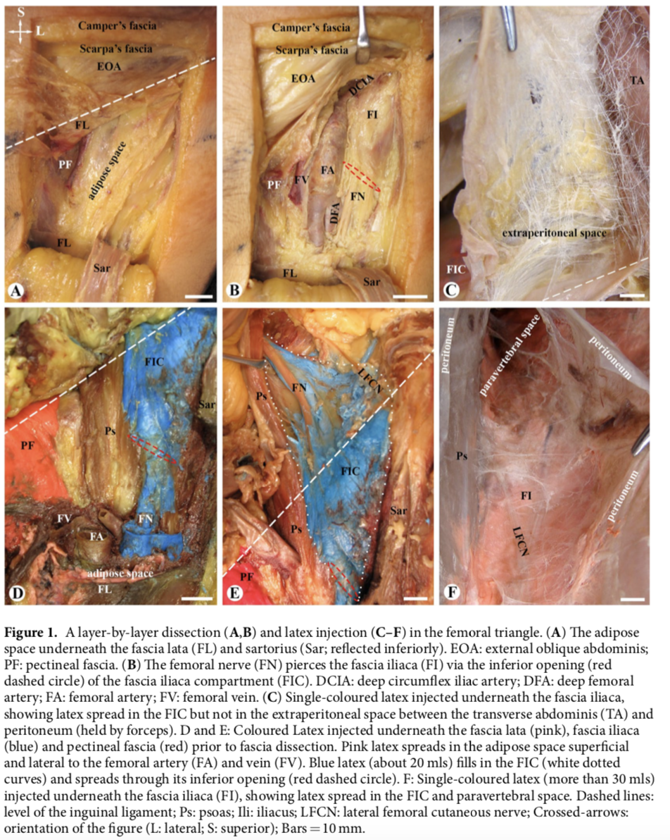 Configuration fibreuse du compartiment fascia iliaca par plastination