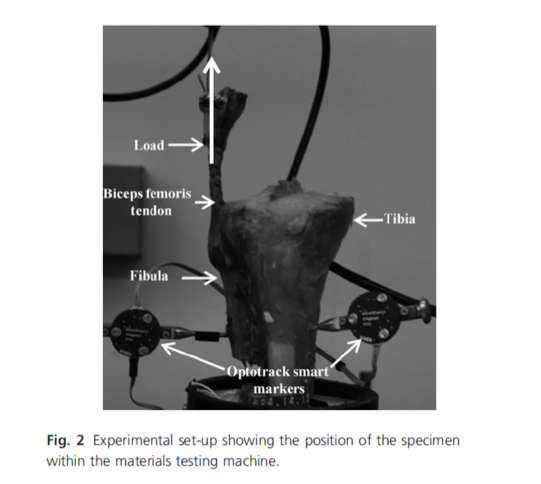 Anatomie de l'articulation tibio-fibulaire proximale et de la membrane interosseuse, et leur contribution à la cinématique articulaire chez les amputés sous le genou