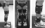 Différences dans l'adduction du genou et de la hanche et l'activation musculaire proximale chez les coureurs avec et sans syndrome de la bandelette ilio-tibiale