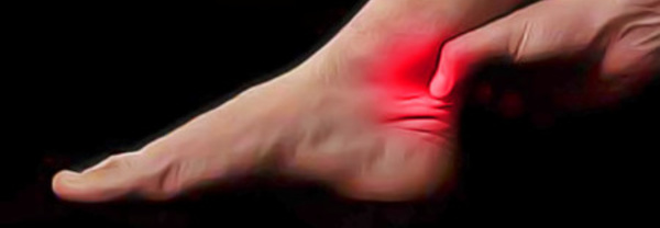 L'inflammation chronique est une caractéristique de la tendinopathie et de la rupture du tendon d'Achille