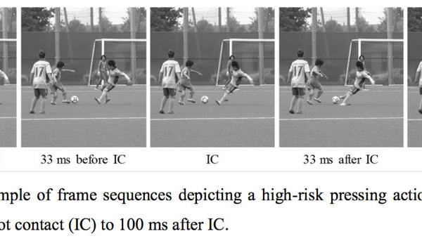 Analyse cinématique des situations de pressing dans le football féminin universitaire : nouvel aperçu des causes de lésion du LCA.