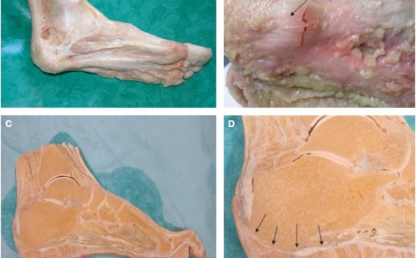 Anatomie du fascia plantaire et relation avec le tendon et le paratenon achiléen.