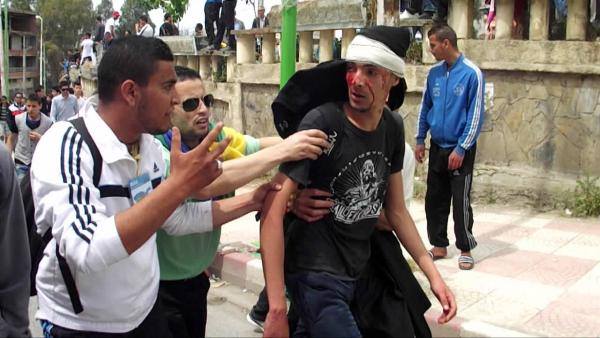 Manifestant kabyle blessé par les CNS algériens à Tizi-Wezzu ce 20/04/2014 (PH/Massyles Amazigh)