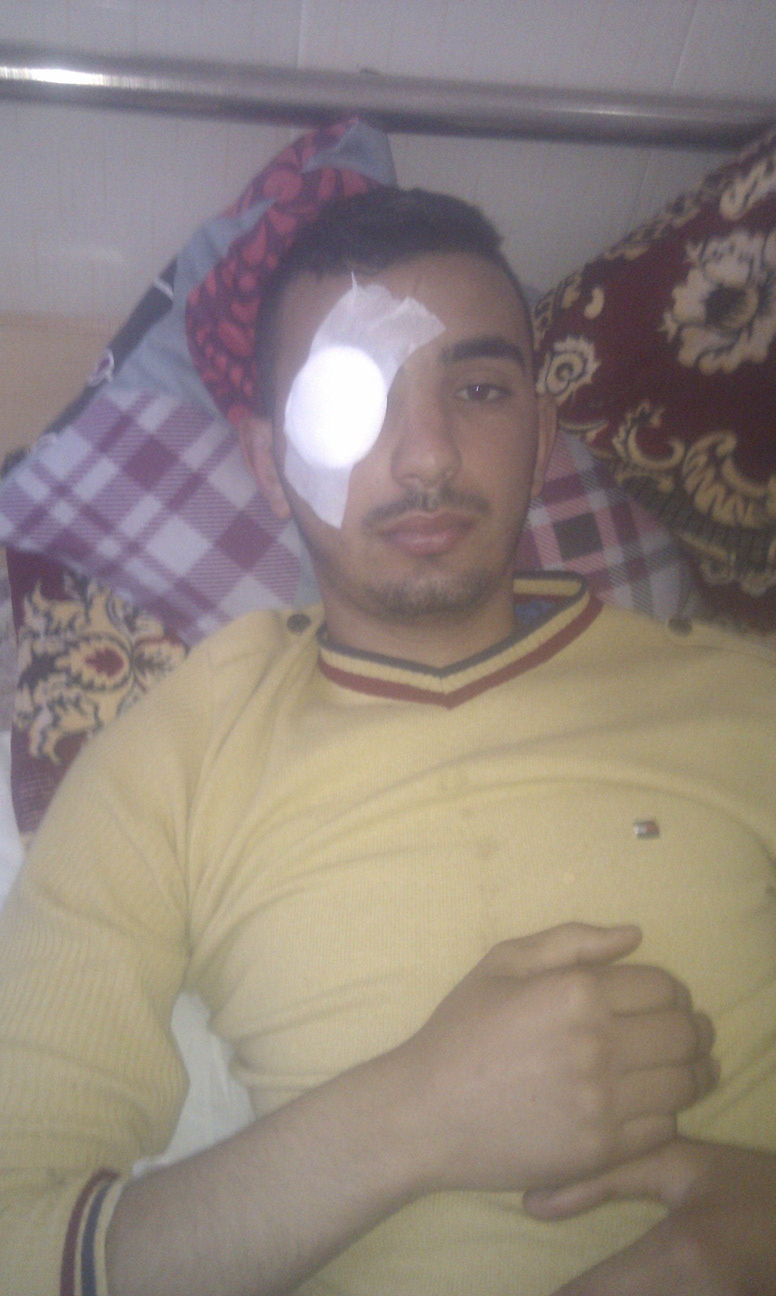 Le jeune Lounis Aliouat touché à l'oeil (PH/DR)
